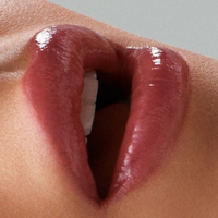 Dermal Fillers