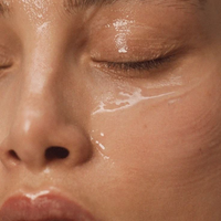 Laser Active Acne